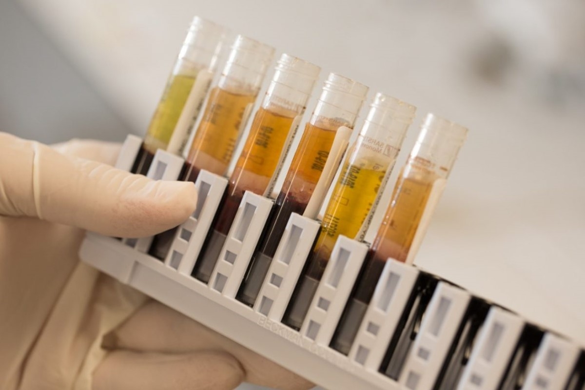 Conheça os diferentes tipos de testes para Covid-19